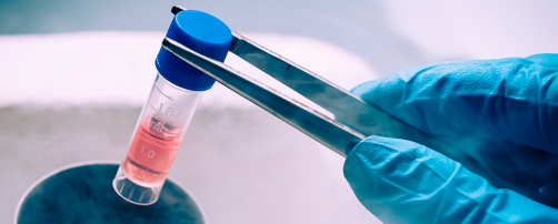 Imagem Plano de Saúde e Criopreservação: quando a Justiça reconhece o direito ao reembolso e à indenização por negativa de cobertura