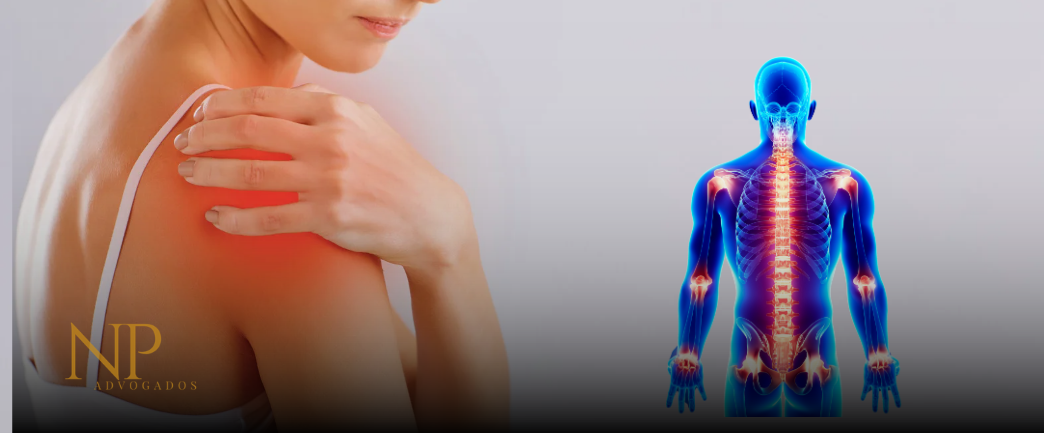 Imagem do artigoNova lei garante benefícios, cotas e proteção previdenciária a quem vive com fibromialgia. Conheça seus direitos